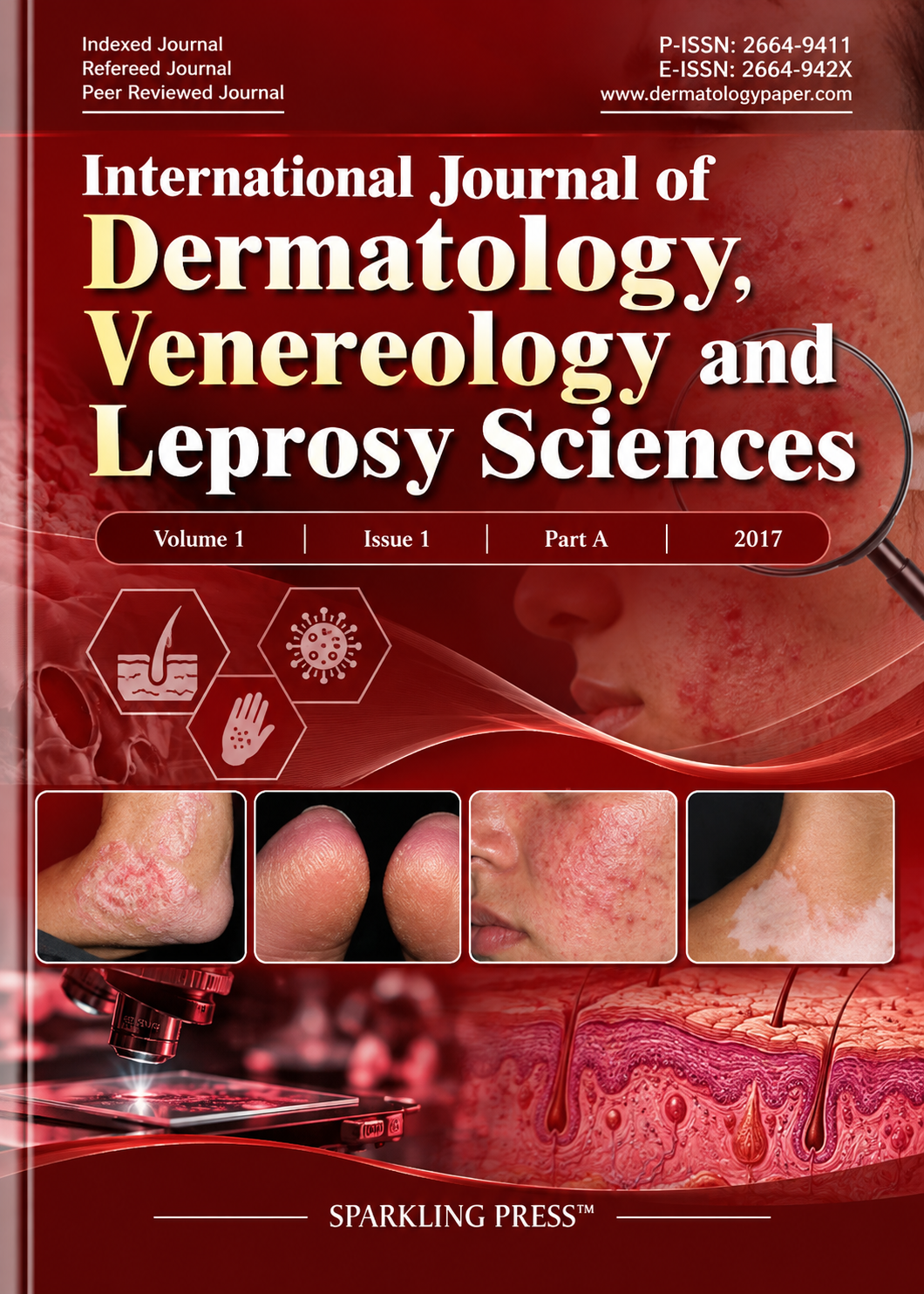 International Journal of Dermatology, Venereology and Leprosy Sciences