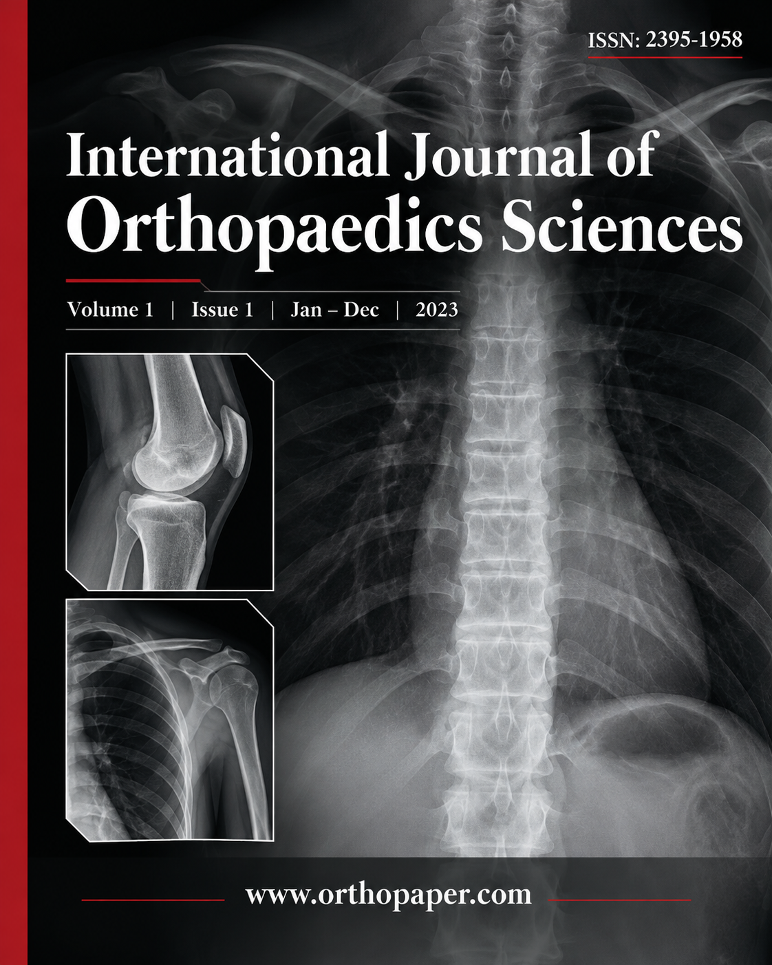 International Journal of Orthopaedics Sciences